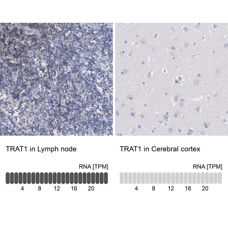 TRIM Antibody - BSA Free Immunohistochemistry-Paraffin: TRIM Antibody - BSA Free [NBP1-89660]