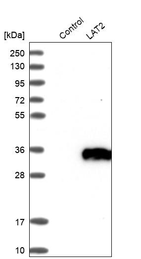 NTAL Antibody - BSA Free Western Blot: NTAL Antibody - BSA Free [NBP1-89661]