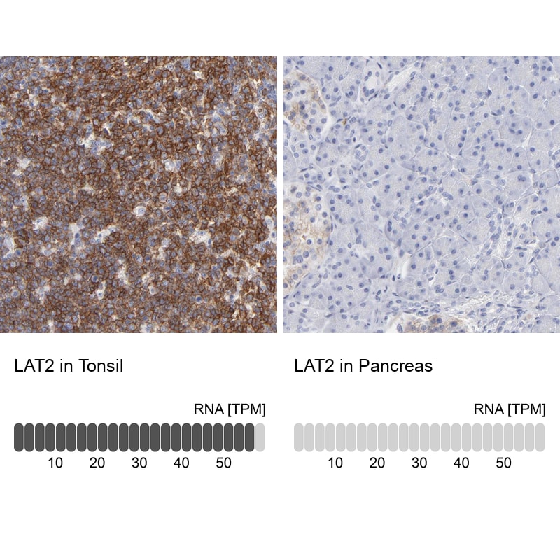 NTAL Antibody - BSA Free Immunohistochemistry-Paraffin: NTAL Antibody - BSA Free [NBP1-89661]