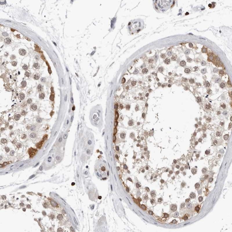 HSPH1/HSP105 Antibody - BSA Free Immunohistochemistry-Paraffin: HSPH1/HSP105 Antibody - BSA Free [NBP1-89662]