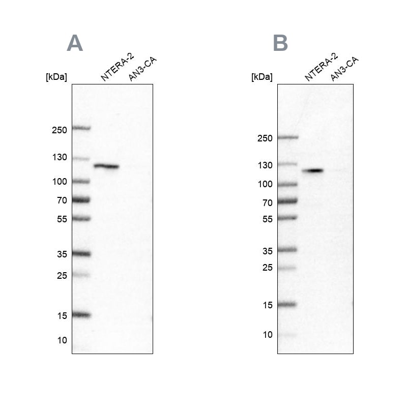 HSPH1/HSP105 Antibody - BSA Free Western Blot: HSPH1/HSP105 Antibody - BSA Free [NBP1-89662]