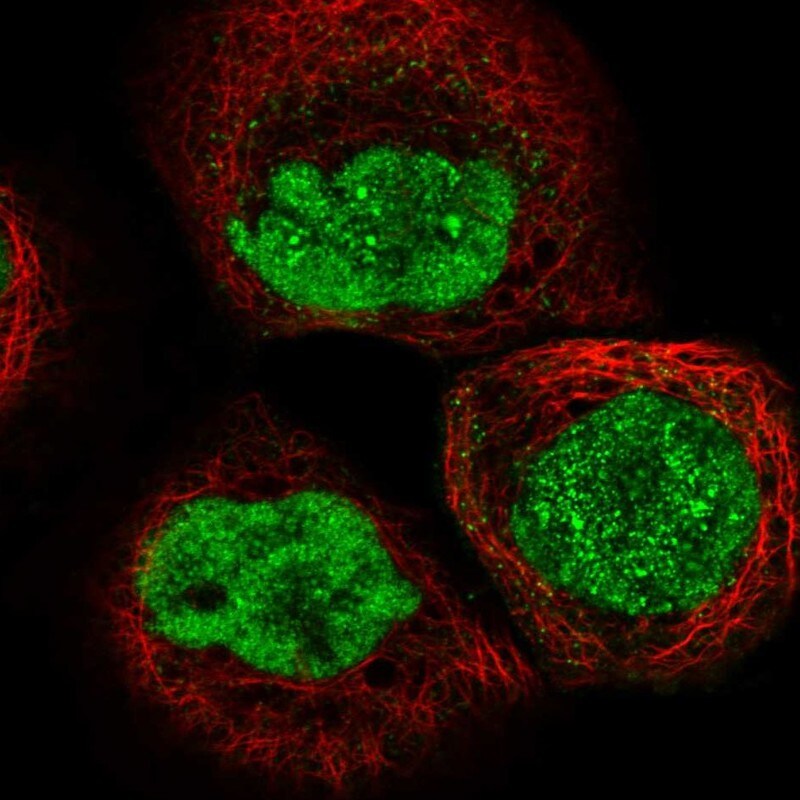 SNM1 Antibody - BSA Free Immunocytochemistry/ Immunofluorescence: SNM1 Antibody - BSA Free [NBP1-89663]
