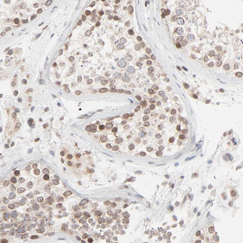 MAD1L1/MAD1 Antibody - BSA Free Immunohistochemistry-Paraffin: MAD1L1/MAD1 Antibody - BSA Free [NBP1-89664]