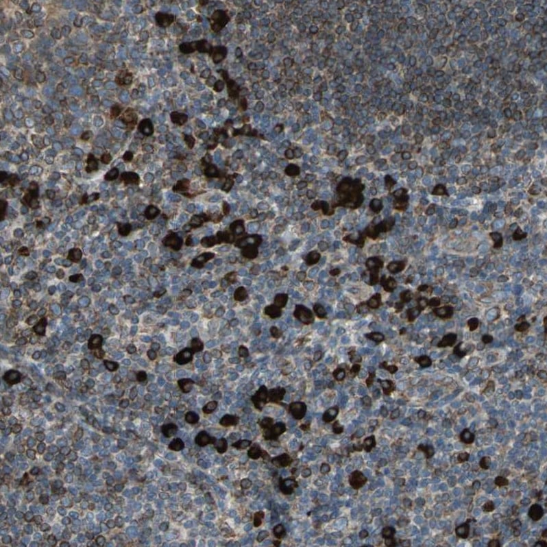 HRD1 Antibody - BSA Free Immunohistochemistry-Paraffin: HRD1 Antibody - BSA Free [NBP1-89667]