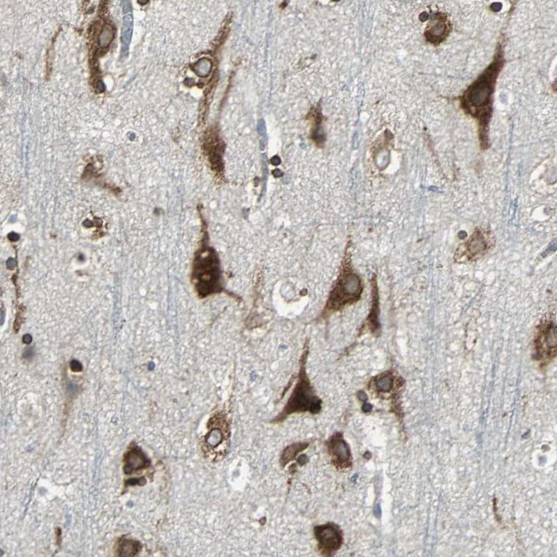 HRD1 Antibody - BSA Free Immunohistochemistry-Paraffin: HRD1 Antibody - BSA Free [NBP1-89667]