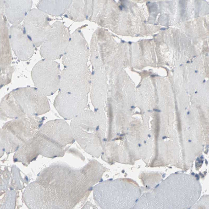 HRD1 Antibody - BSA Free Immunohistochemistry-Paraffin: HRD1 Antibody - BSA Free [NBP1-89667]