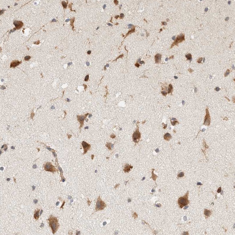 HRD1 Antibody - BSA Free Immunohistochemistry-Paraffin: HRD1 Antibody - BSA Free [NBP1-89668]