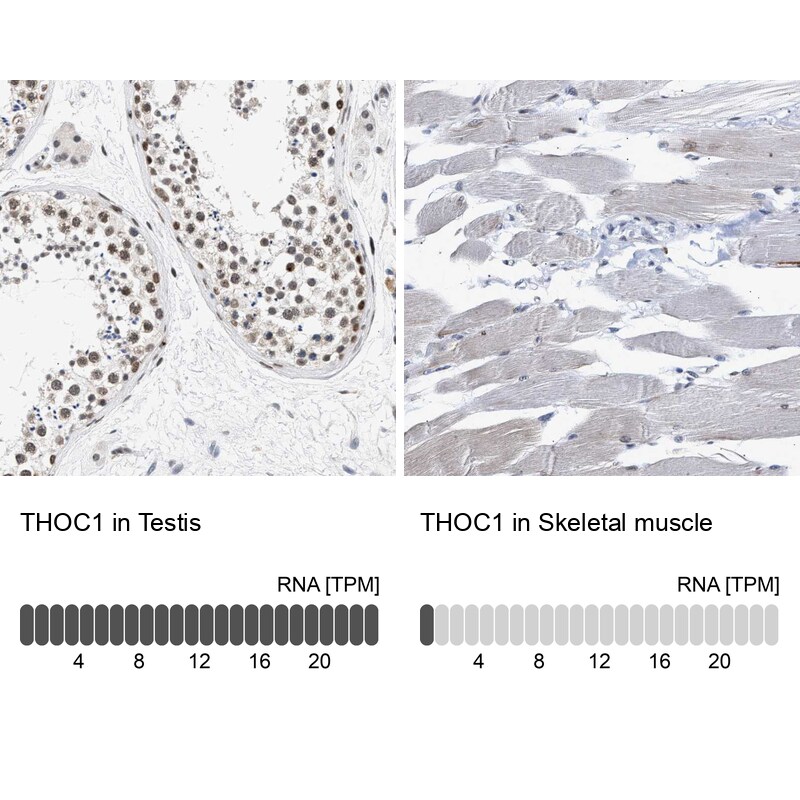 hHpr1-p84-Thoc1 Antibody - BSA Free Immunohistochemistry-Paraffin: hHpr1-p84-Thoc1 Antibody - BSA Free [NBP1-89670]