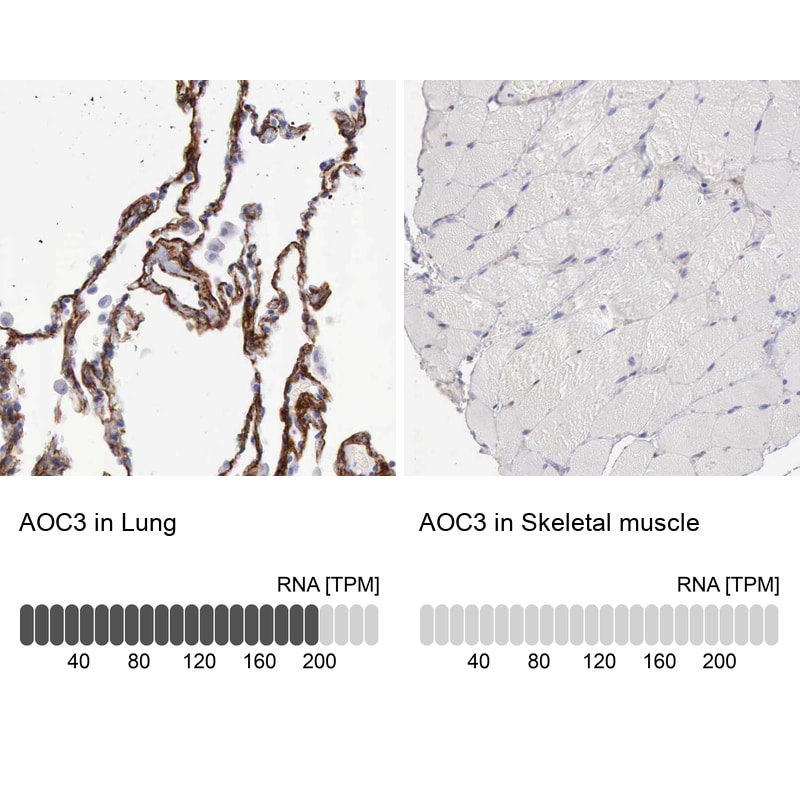 VAP-1/AOC3 Antibody - BSA Free Immunohistochemistry-Paraffin: VAP-1/AOC3 Antibody - BSA Free [NBP1-89671]