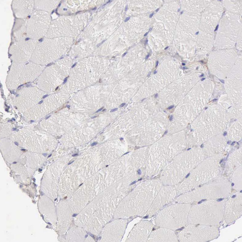 VAP-1/AOC3 Antibody - BSA Free Immunohistochemistry-Paraffin: VAP-1/AOC3 Antibody - BSA Free [NBP1-89671]