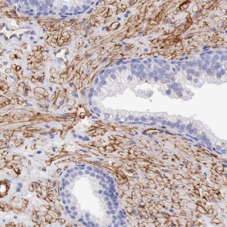 VAP-1/AOC3 Antibody - BSA Free Immunohistochemistry-Paraffin: VAP-1/AOC3 Antibody - BSA Free [NBP1-89671]