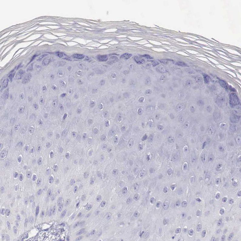 VAP-1/AOC3 Antibody - BSA Free Immunohistochemistry-Paraffin: VAP-1/AOC3 Antibody - BSA Free [NBP1-89671]