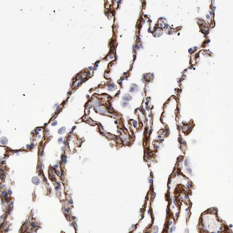 VAP-1/AOC3 Antibody - BSA Free Immunohistochemistry-Paraffin: VAP-1/AOC3 Antibody - BSA Free [NBP1-89671]
