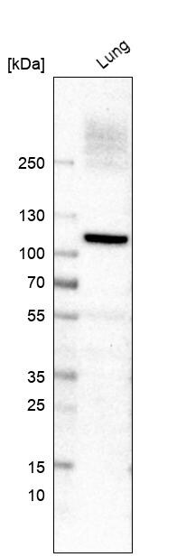VAP-1/AOC3 Antibody - BSA Free Western Blot: VAP-1/AOC3 Antibody - BSA Free [NBP1-89671]