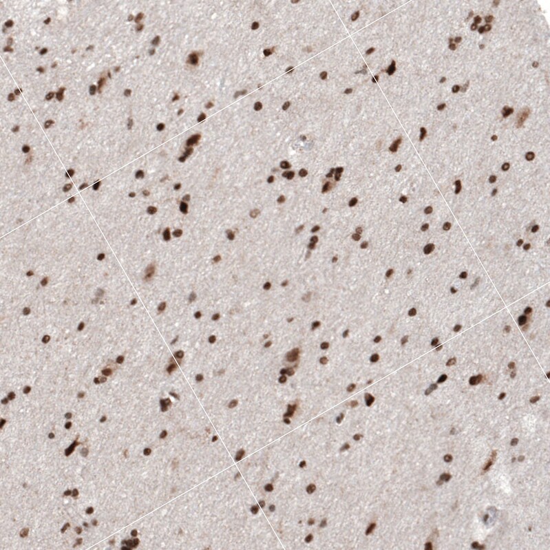 HP1 alpha Antibody - BSA Free Immunohistochemistry-Paraffin: HP1 alpha Antibody - BSA Free [NBP1-89672]