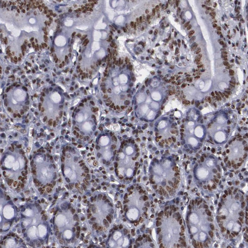 hnRNP A2B1 Antibody - BSA Free Immunohistochemistry-Paraffin: hnRNP A2B1 Antibody - BSA Free [NBP1-89675]