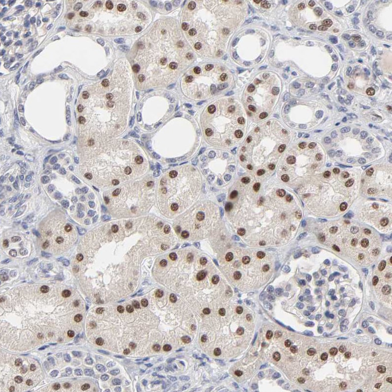HNF-4 alpha/NR2A1 Antibody - BSA Free Immunohistochemistry-Paraffin: HNF-4 alpha/NR2A1 Antibody - BSA Free [NBP1-89679]