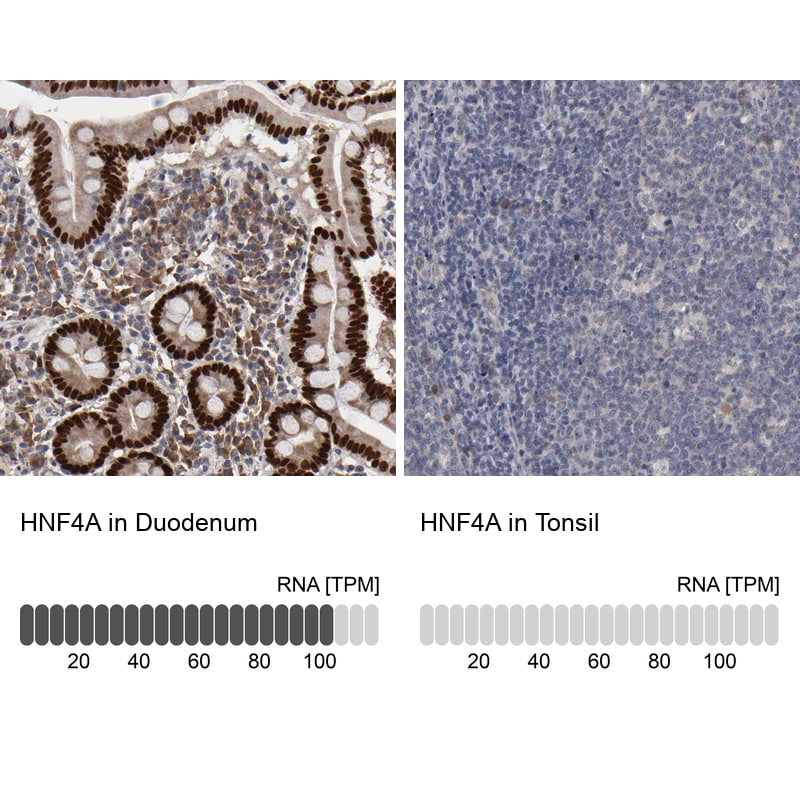 HNF-4 alpha/NR2A1 Antibody - BSA Free Immunohistochemistry-Paraffin: HNF-4 alpha/NR2A1 Antibody - BSA Free [NBP1-89679]