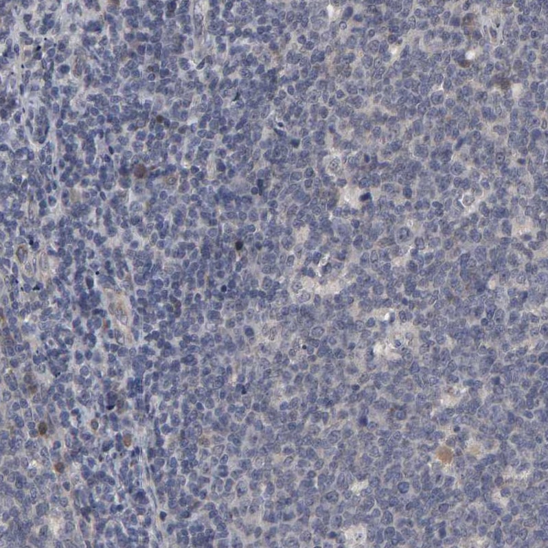 HNF-4 alpha/NR2A1 Antibody - BSA Free Immunohistochemistry-Paraffin: HNF-4 alpha/NR2A1 Antibody - BSA Free [NBP1-89679]