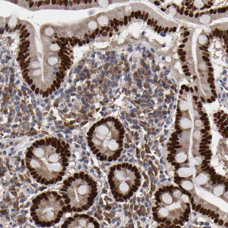 HNF-4 alpha/NR2A1 Antibody - BSA Free Immunohistochemistry-Paraffin: HNF-4 alpha/NR2A1 Antibody - BSA Free [NBP1-89679]