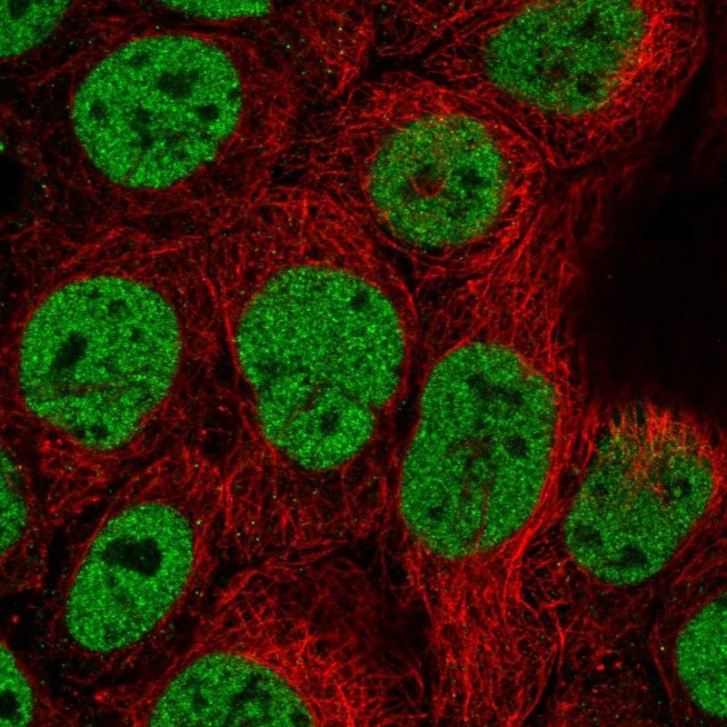 TCF-2/HNF-1 beta Antibody - BSA Free Immunocytochemistry/ Immunofluorescence: TCF-2/HNF-1 beta Antibody - BSA Free [NBP1-89680]