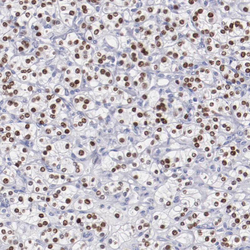 TCF-2/HNF-1 beta Antibody - BSA Free Immunohistochemistry-Paraffin: TCF-2/HNF-1 beta Antibody - BSA Free [NBP1-89680]
