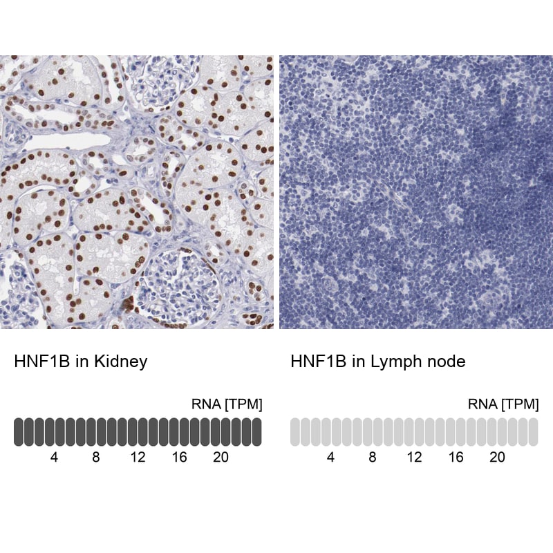TCF-2/HNF-1 beta Antibody - BSA Free Immunohistochemistry-Paraffin: TCF-2/HNF-1 beta Antibody - BSA Free [NBP1-89680]