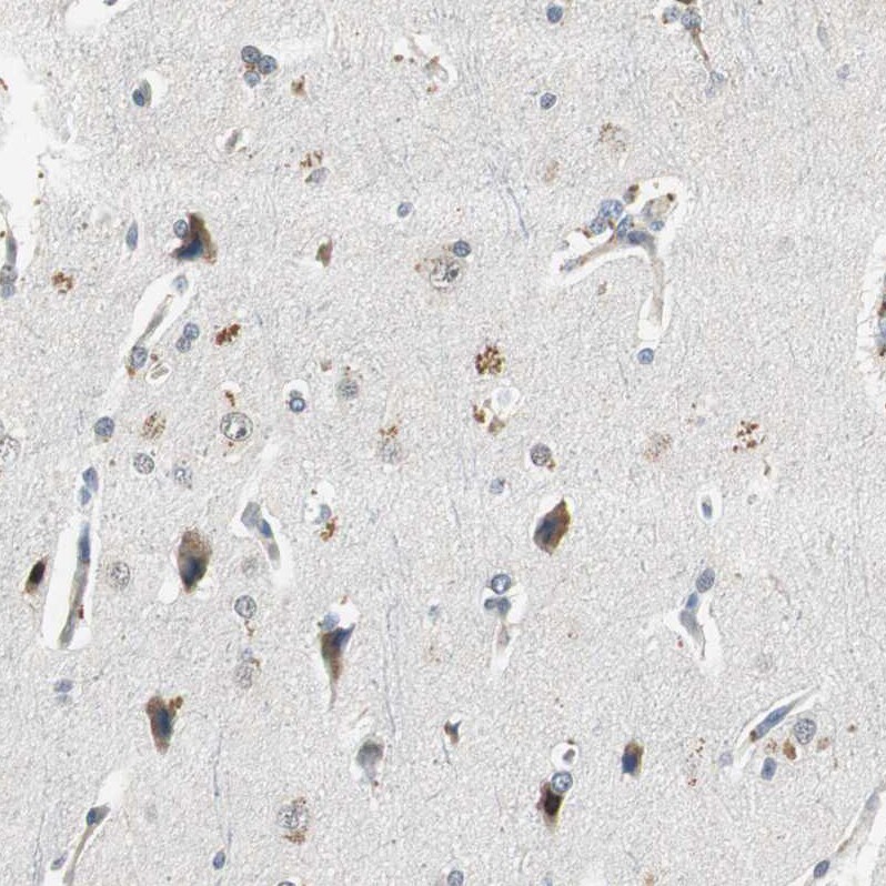 Proteasome subunit beta type 4 Antibody - BSA Free Immunohistochemistry-Paraffin: Proteasome subunit beta type 4 Antibody - BSA Free [NBP1-89681]