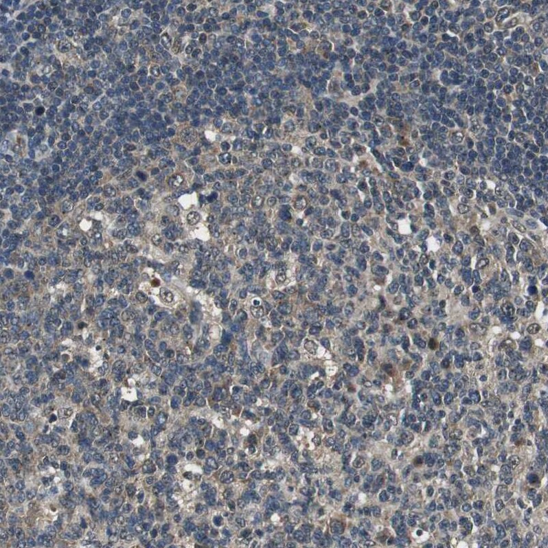 Proteasome subunit beta type 4 Antibody - BSA Free Immunohistochemistry-Paraffin: Proteasome subunit beta type 4 Antibody - BSA Free [NBP1-89681]