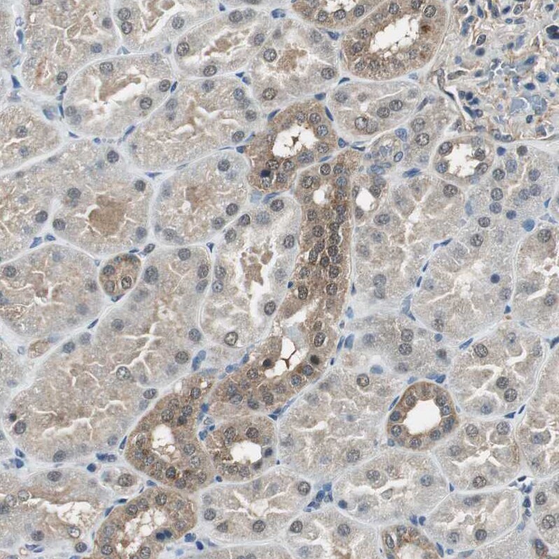 Proteasome subunit beta type 4 Antibody - BSA Free Immunohistochemistry-Paraffin: Proteasome subunit beta type 4 Antibody - BSA Free [NBP1-89681]