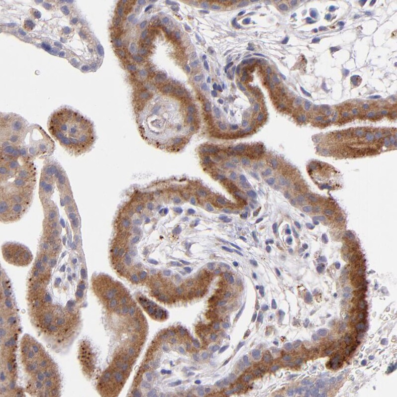 MDA5 Antibody - BSA Free Immunohistochemistry-Paraffin: MDA5 Antibody - BSA Free [NBP1-89685]