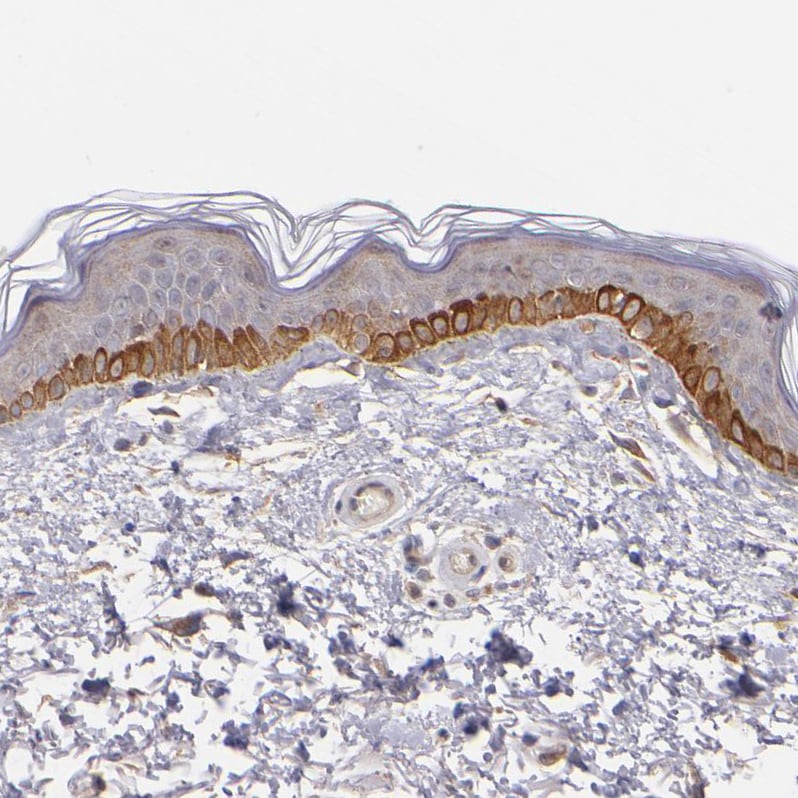 MDA5 Antibody - BSA Free Immunohistochemistry-Paraffin: MDA5 Antibody - BSA Free [NBP1-89685]