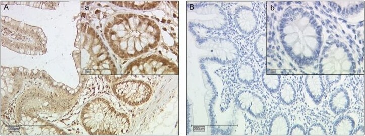 Galectin-2 Antibody