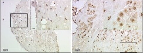 Galectin-2 Antibody