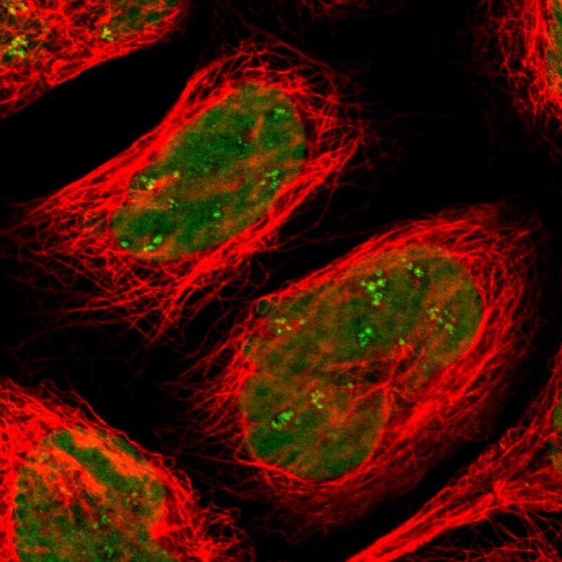 SMARCA5/SNF2H Antibody - BSA Free Immunocytochemistry/ Immunofluorescence: SMARCA5/SNF2H Antibody [NBP1-89692]
