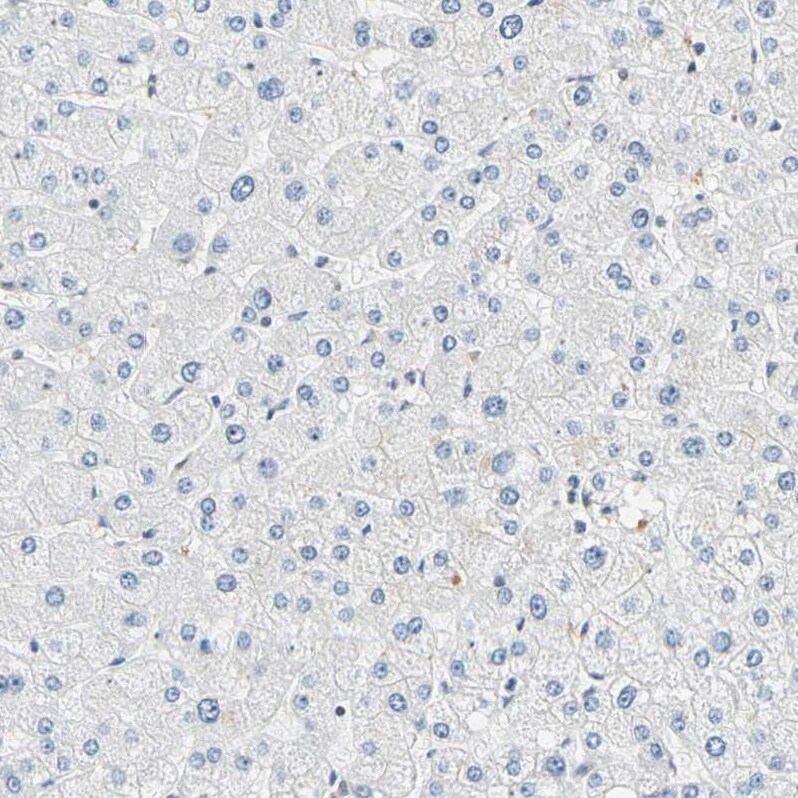 SMARCA5/SNF2H Antibody - BSA Free Immunohistochemistry-Paraffin: SMARCA5/SNF2H Antibody - BSA Free [NBP1-89692]