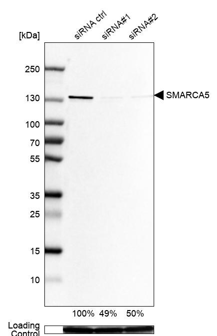 SMARCA5/SNF2H Antibody - BSA Free Western Blot: SMARCA5/SNF2H Antibody - BSA Free [NBP1-89692]