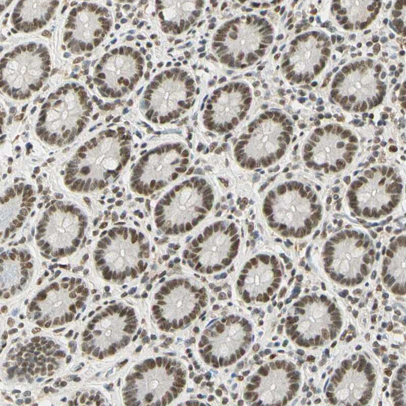 SMARCA5/SNF2H Antibody - BSA Free Immunohistochemistry-Paraffin: SMARCA5/SNF2H Antibody - BSA Free [NBP1-89692]