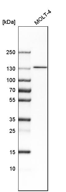 SMARCA5/SNF2H Antibody - BSA Free Western Blot: SMARCA5/SNF2H Antibody - BSA Free [NBP1-89692]