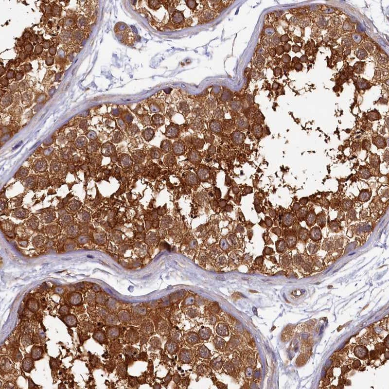 HISPPD2A Antibody - BSA Free Immunohistochemistry-Paraffin: HISPPD2A Antibody [NBP1-89693]