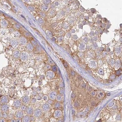 Histidase Antibody - BSA Free Immunohistochemistry-Paraffin: Histidase Antibody [NBP1-89695]