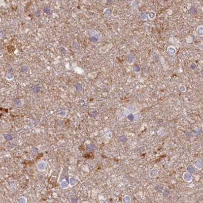 Histidase Antibody - BSA Free Immunohistochemistry-Paraffin: Histidase Antibody [NBP1-89695]