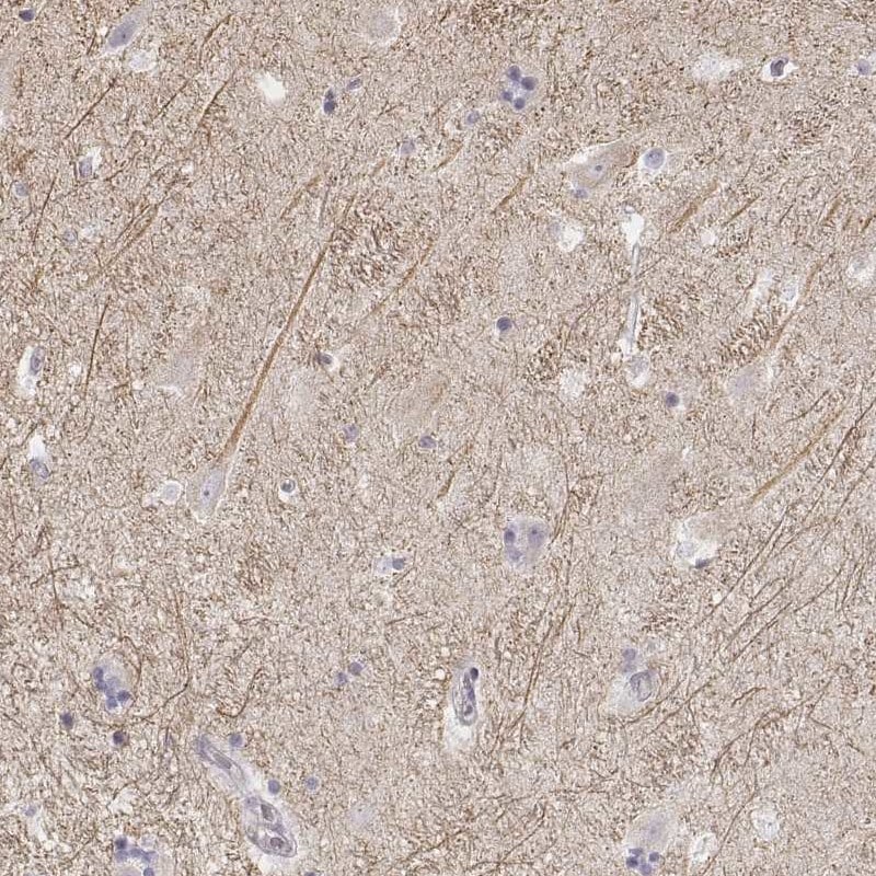 Kir2.2 Antibody - BSA Free Immunohistochemistry-Paraffin: Kir2.2 Antibody - BSA Free [NBP1-89696]