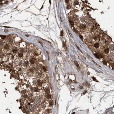 hHR23b Antibody - BSA Free Immunohistochemistry-Paraffin: hHR23b Antibody [NBP1-89699]