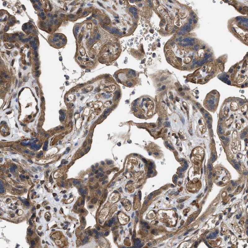 Frizzled-6 Antibody - BSA Free Immunohistochemistry-Paraffin: Frizzled-6 Antibody [NBP1-89702]