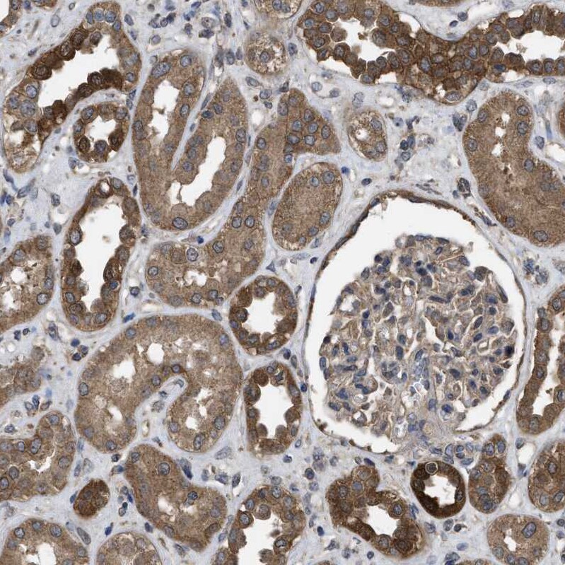 Frizzled-6 Antibody - BSA Free Immunohistochemistry-Paraffin: Frizzled-6 Antibody [NBP1-89702]