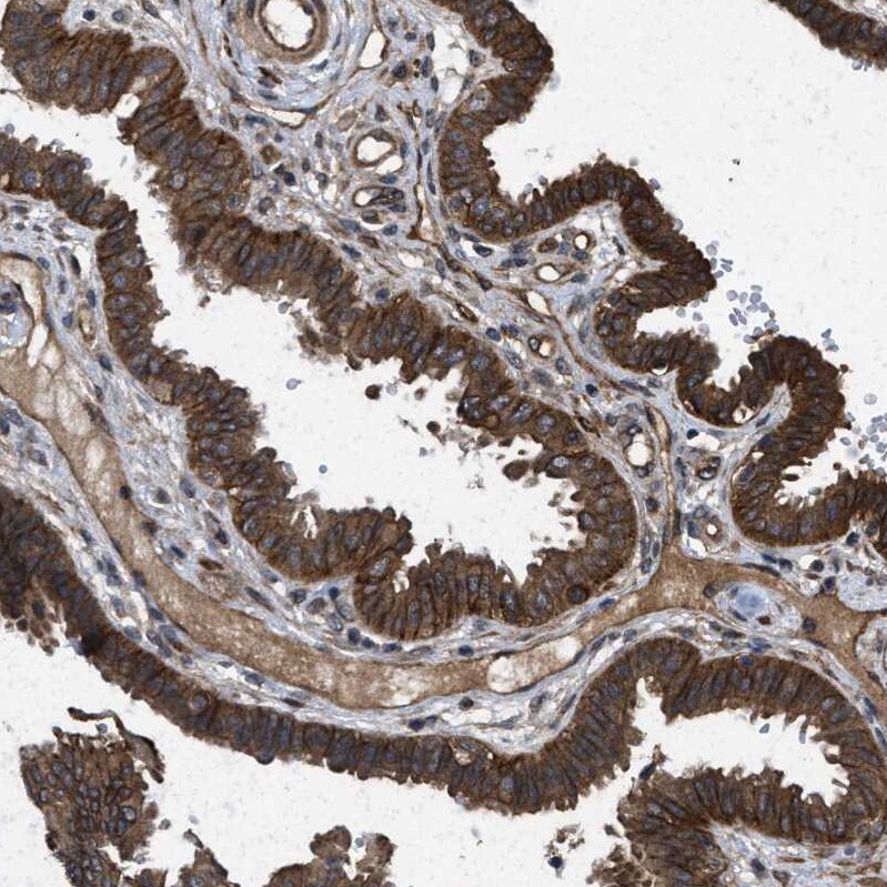 Frizzled-6 Antibody - BSA Free Immunohistochemistry-Paraffin: Frizzled-6 Antibody - BSA Free [NBP1-89702]