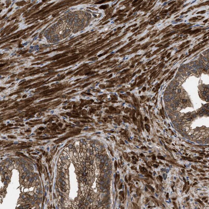 Frizzled-6 Antibody - BSA Free Immunohistochemistry-Paraffin: Frizzled-6 Antibody - BSA Free [NBP1-89702]