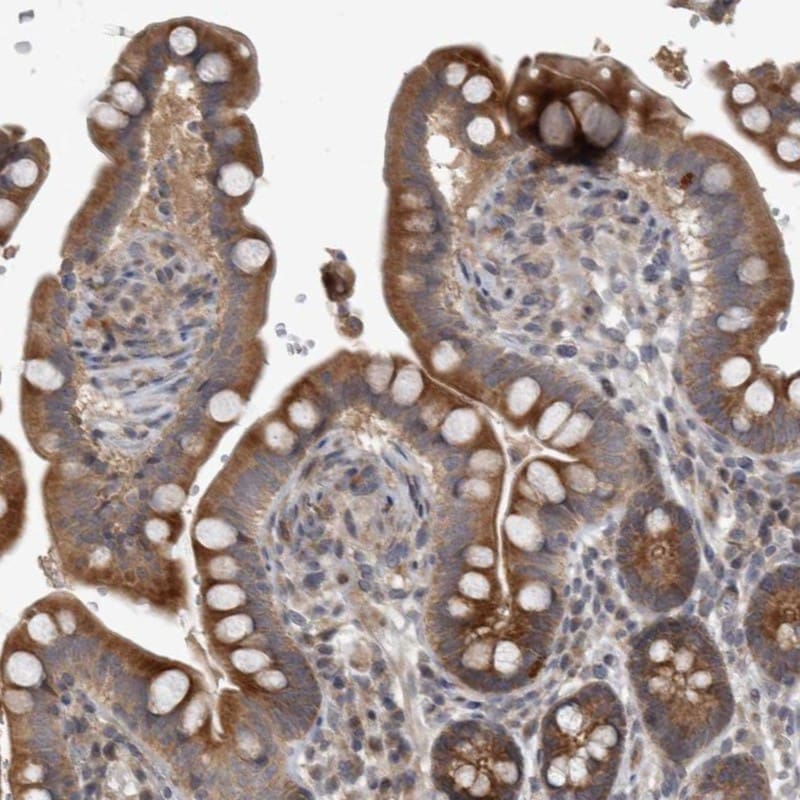 GTP binding protein era homolog Antibody - BSA Free Immunohistochemistry-Paraffin: GTP binding protein era homolog Antibody - BSA Free [NBP1-89703]