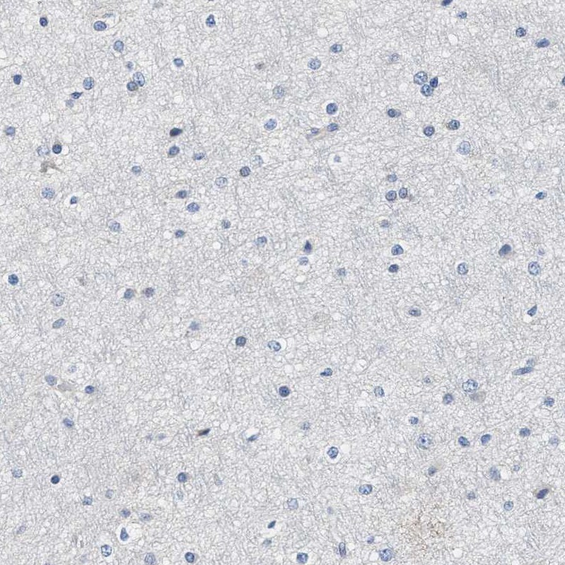 Myosin Heavy Chain 3 Antibody - BSA Free Immunohistochemistry-Paraffin: Myosin Heavy Chain 3 Antibody - BSA Free [NBP1-89707]